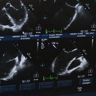 Schwangerschaftsabbruch